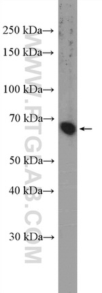 ZNF30 Antibody in Western Blot (WB)