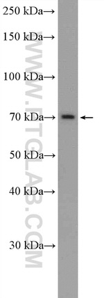 ZNF30 Antibody in Western Blot (WB)