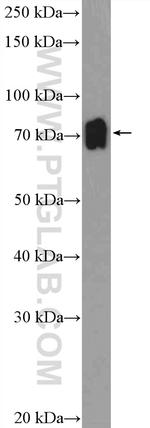 ZNF30 Antibody in Western Blot (WB)