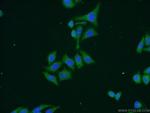 C6orf15 Antibody in Immunocytochemistry (ICC/IF)