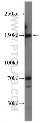 ATAD5 Antibody in Western Blot (WB)
