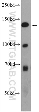 ATAD5 Antibody in Western Blot (WB)