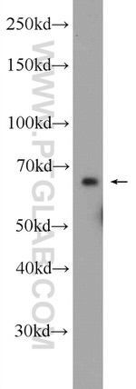 C6orf182 Antibody in Western Blot (WB)