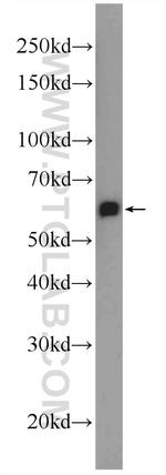 C6orf182 Antibody in Western Blot (WB)