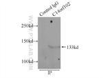 C14orf102 Antibody in Immunoprecipitation (IP)