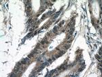 KIAA0087 Antibody in Immunohistochemistry (Paraffin) (IHC (P))