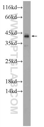 KIAA0087 Antibody in Western Blot (WB)