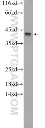 KIAA0087 Antibody in Western Blot (WB)