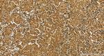 USP4 Antibody in Immunohistochemistry (Paraffin) (IHC (P))