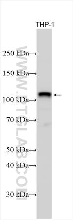 USP4 Antibody in Western Blot (WB)
