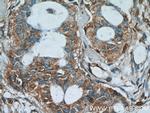 AKAP4 Antibody in Immunohistochemistry (Paraffin) (IHC (P))