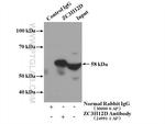 ZC3H12D Antibody in Immunoprecipitation (IP)