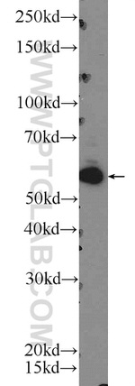 ZC3H12D Antibody in Western Blot (WB)