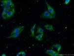 HuD Antibody in Immunocytochemistry (ICC/IF)
