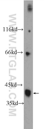 HuD Antibody in Western Blot (WB)