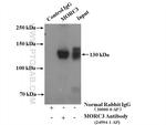 MORC3 Antibody in Immunoprecipitation (IP)