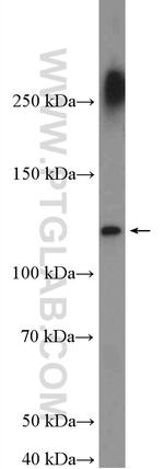 MORC3 Antibody in Western Blot (WB)