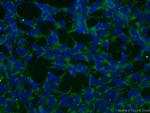 BAALC Antibody in Immunocytochemistry (ICC/IF)