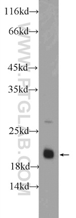 BAALC Antibody in Western Blot (WB)