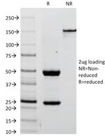 Alkaline Phosphatase (Placental)/PLAP (Germ Cell Tumor Marker) Antibody in SDS-PAGE (SDS-PAGE)