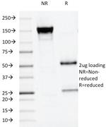 Alkaline Phosphatase (Placental)/PLAP (Germ Cell Tumor Marker) Monoclonal Antibody (ALPP/516)