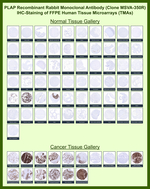 Alkaline Phosphatase (Placental)/PLAP (Germ Cell Tumor Marker) Recombinant Rabbit Monoclonal Antibody (MSVA-350R)