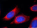 RPL22 Antibody in Immunocytochemistry (ICC/IF)