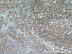 HCLS1 Antibody in Immunohistochemistry (Paraffin) (IHC (P))