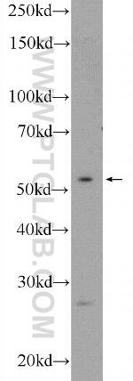 ZIC1 Antibody in Western Blot (WB)
