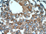 FGFBP1 Antibody in Immunohistochemistry (Paraffin) (IHC (P))