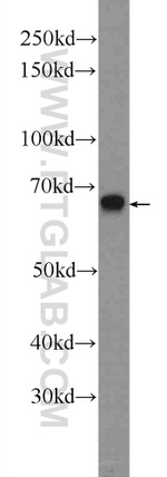 ZC3H12A Antibody in Western Blot (WB)