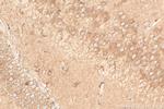 GRIA1 Antibody in Immunohistochemistry (Paraffin) (IHC (P))