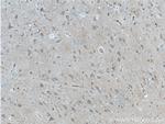GRIA1 Antibody in Immunohistochemistry (Paraffin) (IHC (P))
