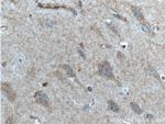 GRIA1 Antibody in Immunohistochemistry (Paraffin) (IHC (P))