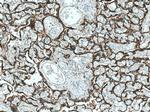 hCG alpha Antibody in Immunohistochemistry (Paraffin) (IHC (P))