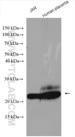 hCG alpha Antibody in Western Blot (WB)