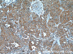 hCG alpha Antibody in Immunohistochemistry (Paraffin) (IHC (P))