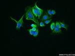 LRCH1 Antibody in Immunocytochemistry (ICC/IF)