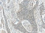 LRCH1 Antibody in Immunohistochemistry (Paraffin) (IHC (P))