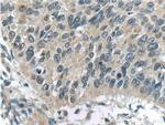 LRCH1 Antibody in Immunohistochemistry (Paraffin) (IHC (P))