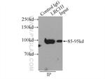 LRCH1 Antibody in Immunoprecipitation (IP)