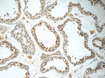 DEC1 Antibody in Immunohistochemistry (Paraffin) (IHC (P))