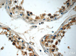 DEC1 Antibody in Immunohistochemistry (Paraffin) (IHC (P))