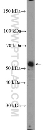 ZNF586 Antibody in Western Blot (WB)