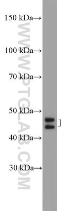 ZNF586 Antibody in Western Blot (WB)