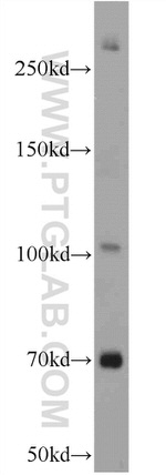 NWD1 Antibody in Western Blot (WB)