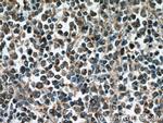 RelB Antibody in Immunohistochemistry (Paraffin) (IHC (P))