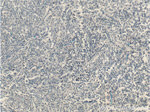 MSC Antibody in Immunohistochemistry (Paraffin) (IHC (P))