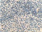 MSC Antibody in Immunohistochemistry (Paraffin) (IHC (P))