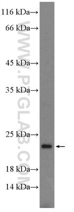 MSC Antibody in Western Blot (WB)